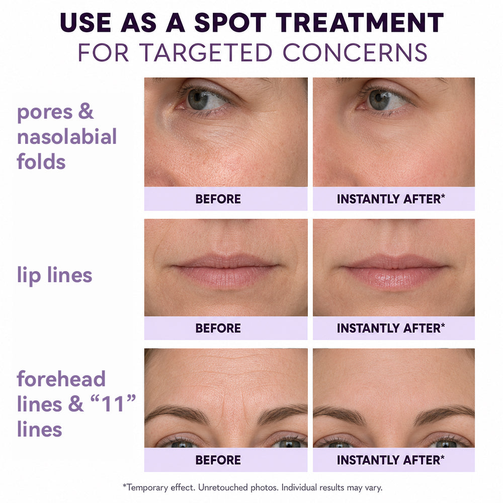 🔥Perfect Instant Face Tightener