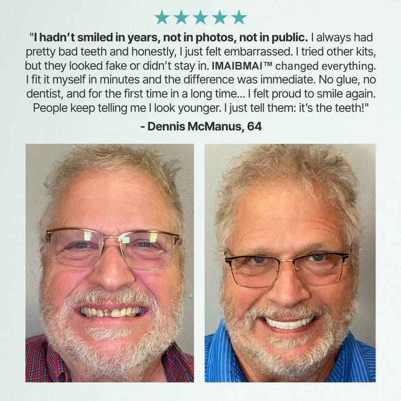 🌎Ends Today: 70% OFF! ⏰Modehealthy™ ADA-Certified Strong Suction Denture