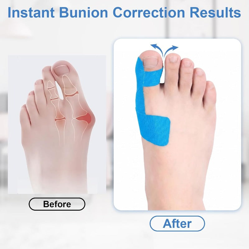 Flexible Big Toe Alignment Support