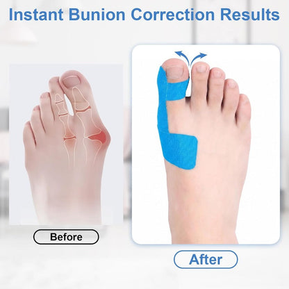 Flexible Big Toe Alignment Support