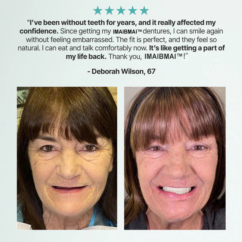 🌎Ends Today: 70% OFF! ⏰Modehealthy™ ADA-Certified Strong Suction Denture